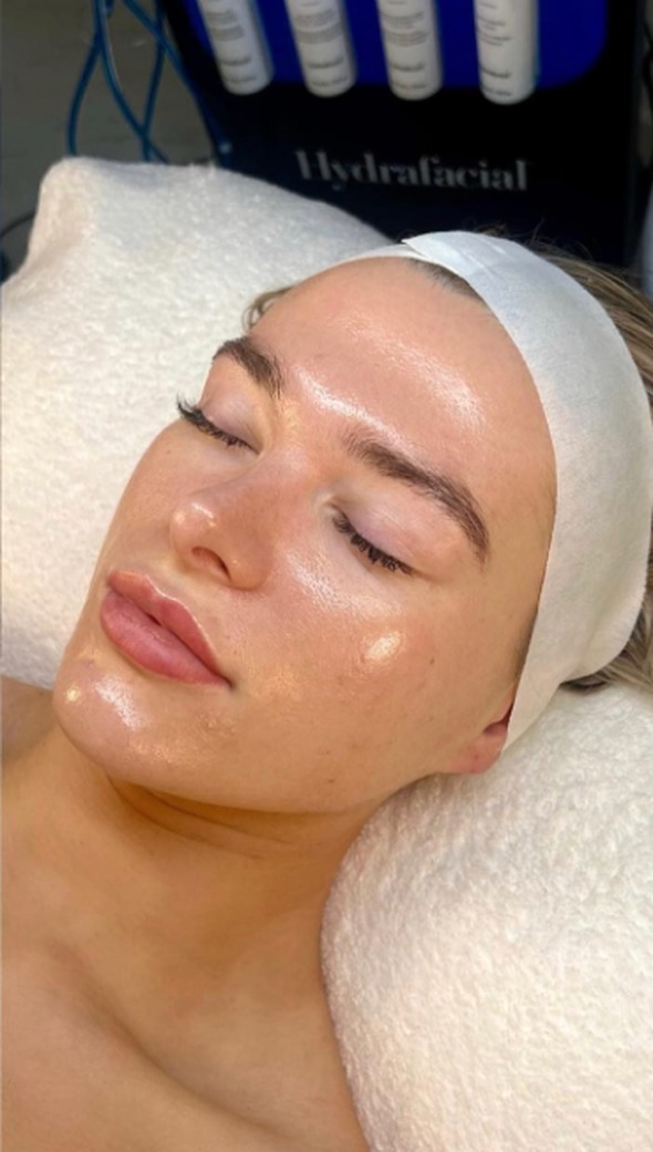 Lugn, hydrerad hud efter en behandling hos Beauty & Lifestyle i Malmö